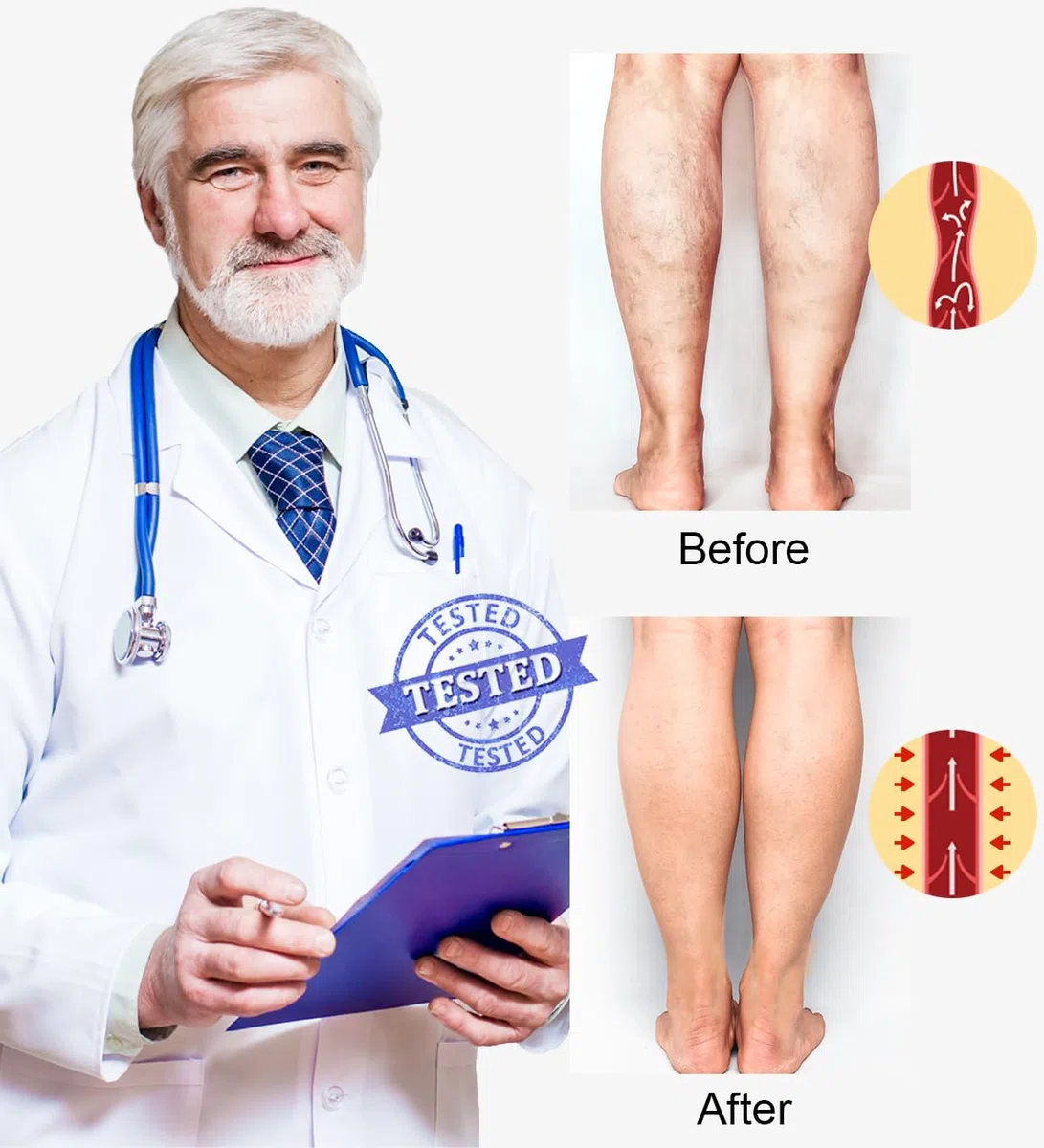 2 Paires Medicale Bas de Contention Femme et Homme 20-30mmhg Classe 2, Mollets Chaussettes de Contention pour Les varices, l'œdème, Vol de Voyage