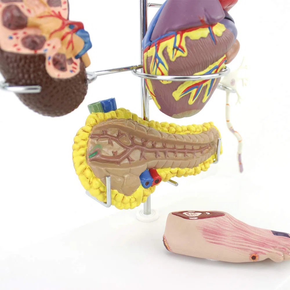 Outils de modèle d'enseignement, modèle de diabète Humain, modèle de cœur, thrombose coronarienne, modèle de diabète artériel, Circulation extracorporelle, vaisseaux sanguins, cerv
