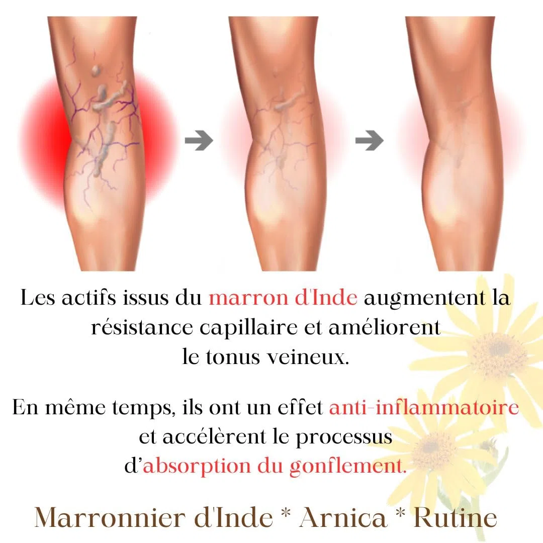 Green idea - Gel de Massage au Marron d'Inde et Arnica contre les Varices 250 ml - Traitement pour Varices et Hémorroïdes - Améliore la Circulation Sanguine - Soulage Rapidement - Veines Saines | Crème Jambes à l'arnica, Marronnier, Rutine, Contre les var