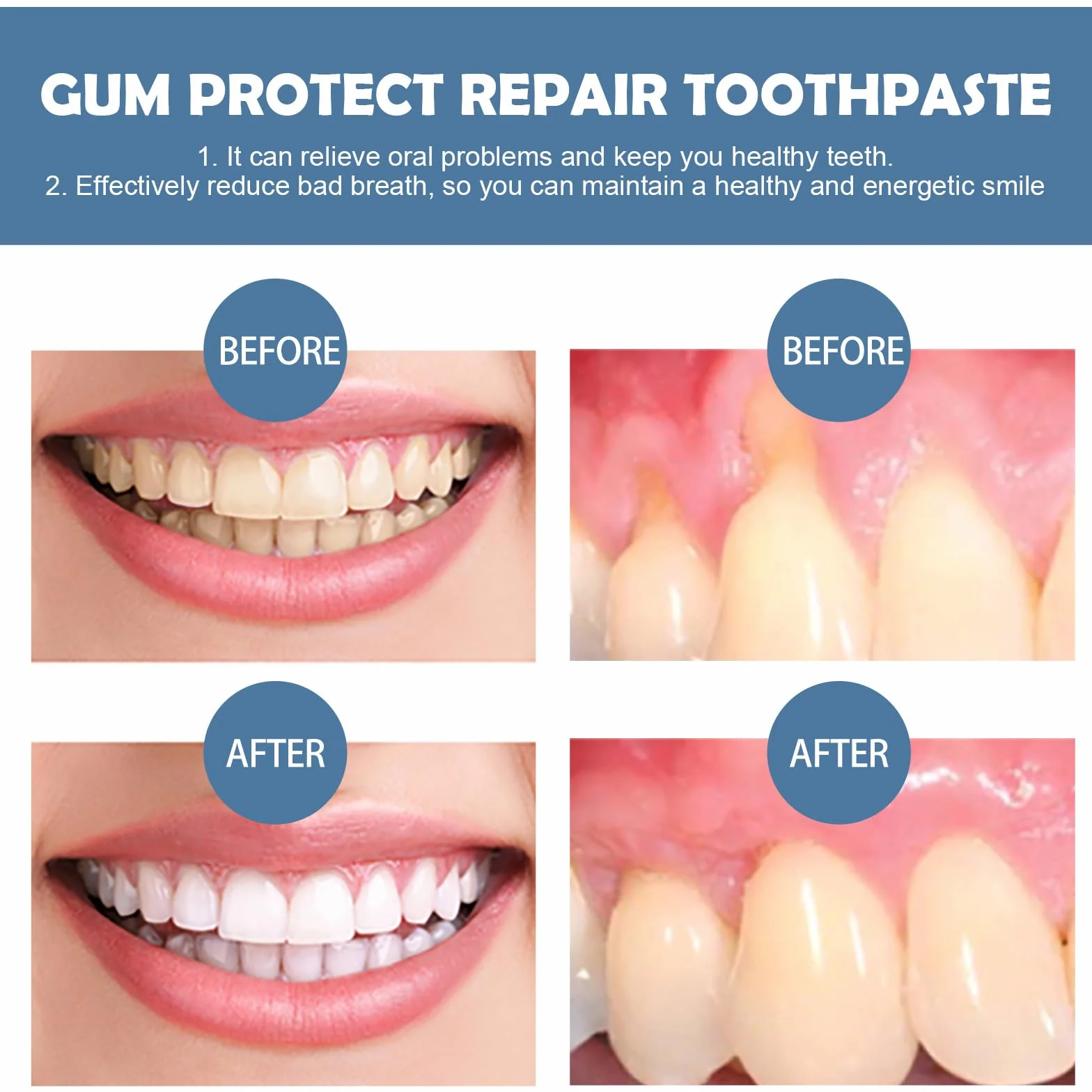 Gum Repair Gel Réparateur De Gencives,Gouttes De Repousse Des Gencives,Favorise La Guérison,Assure Une Haleine Fraîche,30ML
