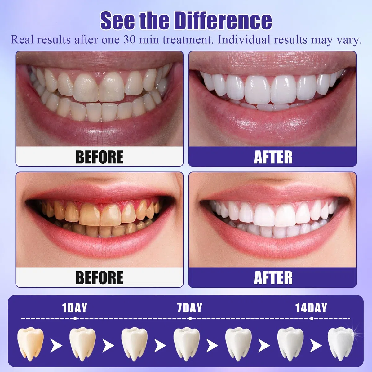 28 PièCes Bandes De Blanchiment Des Dents, Bandes Blanchissantes Violettes, Whitening Strips Efficace, RéDuire Les Taches Profondes, Effet à Domicile, Sourire éClatant