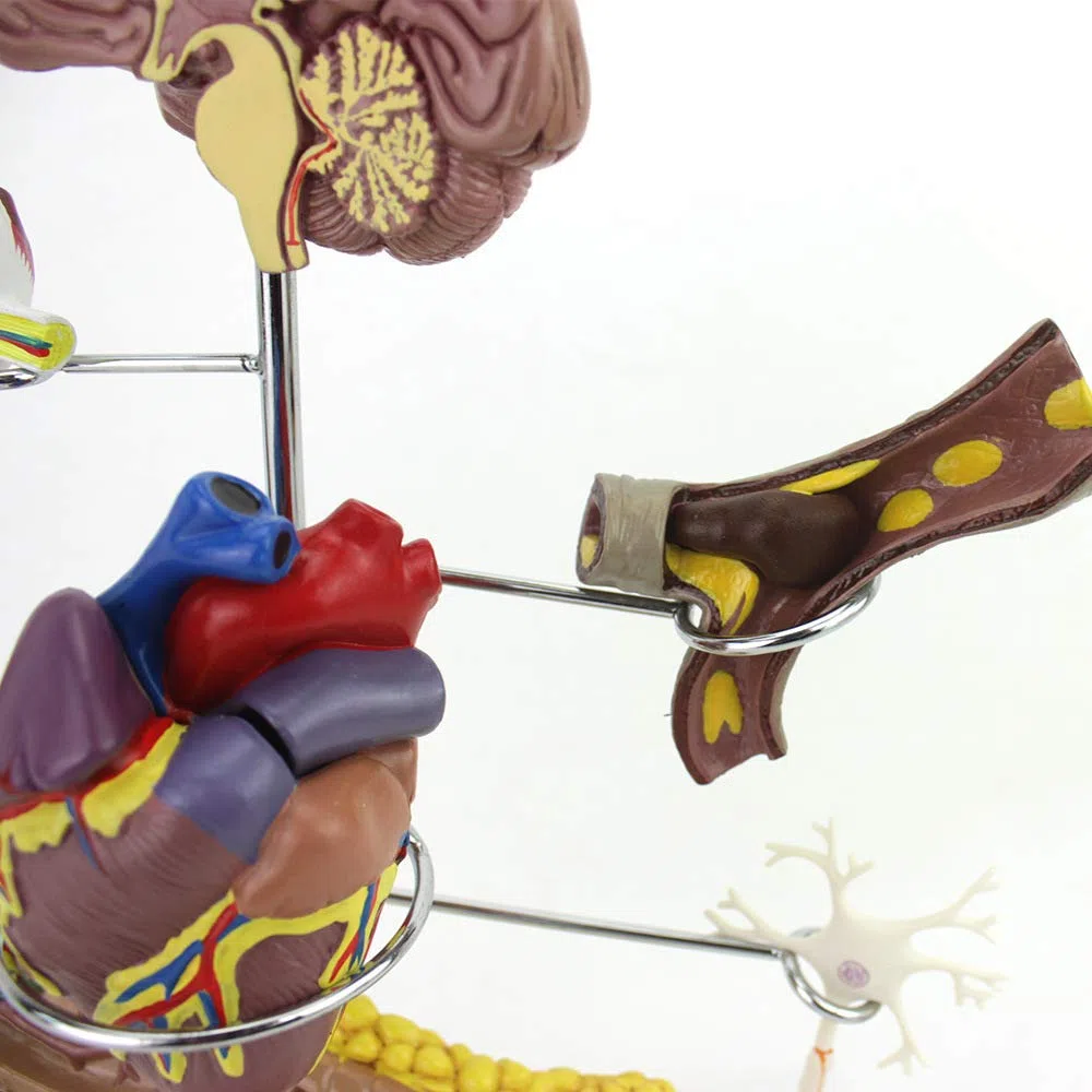 Outils de modèle d'enseignement, modèle de diabète Humain, modèle de cœur, thrombose coronarienne, modèle de diabète artériel, Circulation extracorporelle, vaisseaux sanguins, cerv