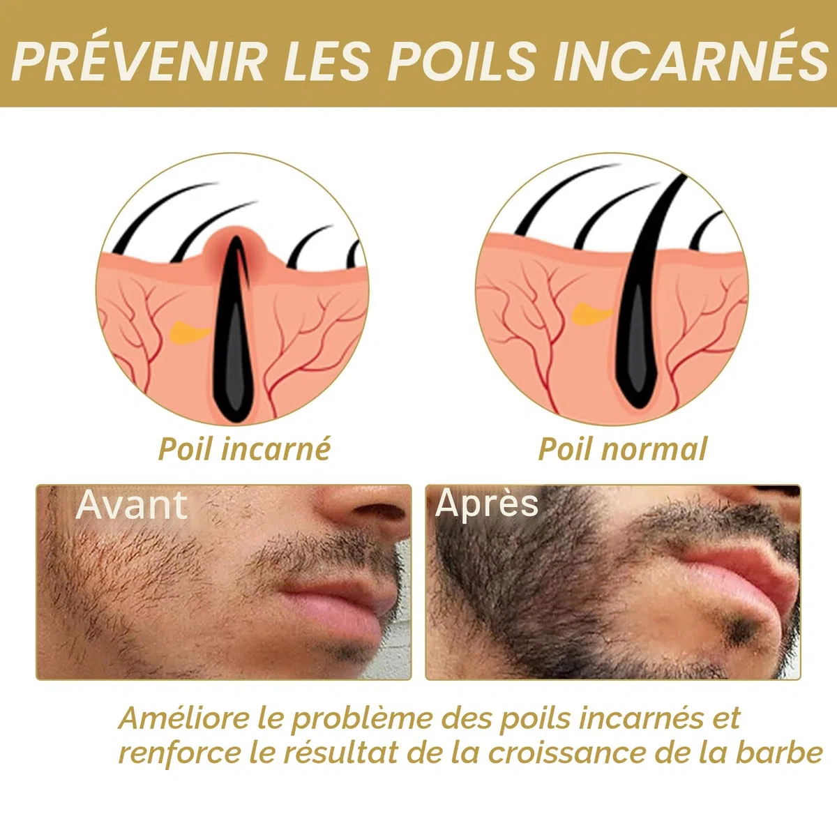 Kit Pousse Barbe,Kit de Croissance de la Barbe,Huile Pousse avec Rouleau,Cadeau Homme (60 ml)